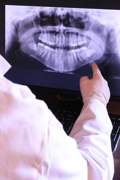 Best Emergency Treatment for Oral Infections in Four Corners, MD